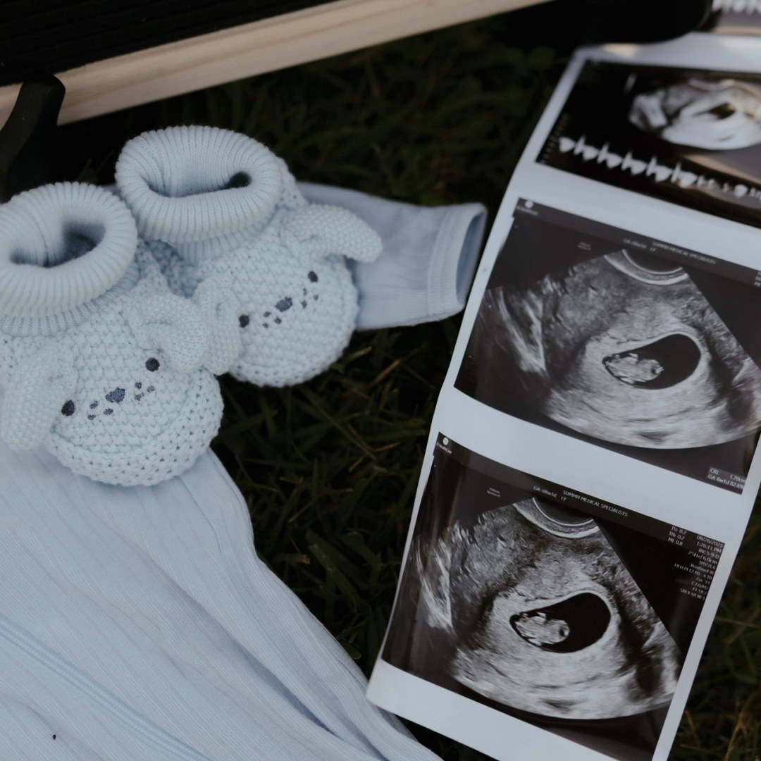 Photo shared by Lacie for their Babylist baby registry.