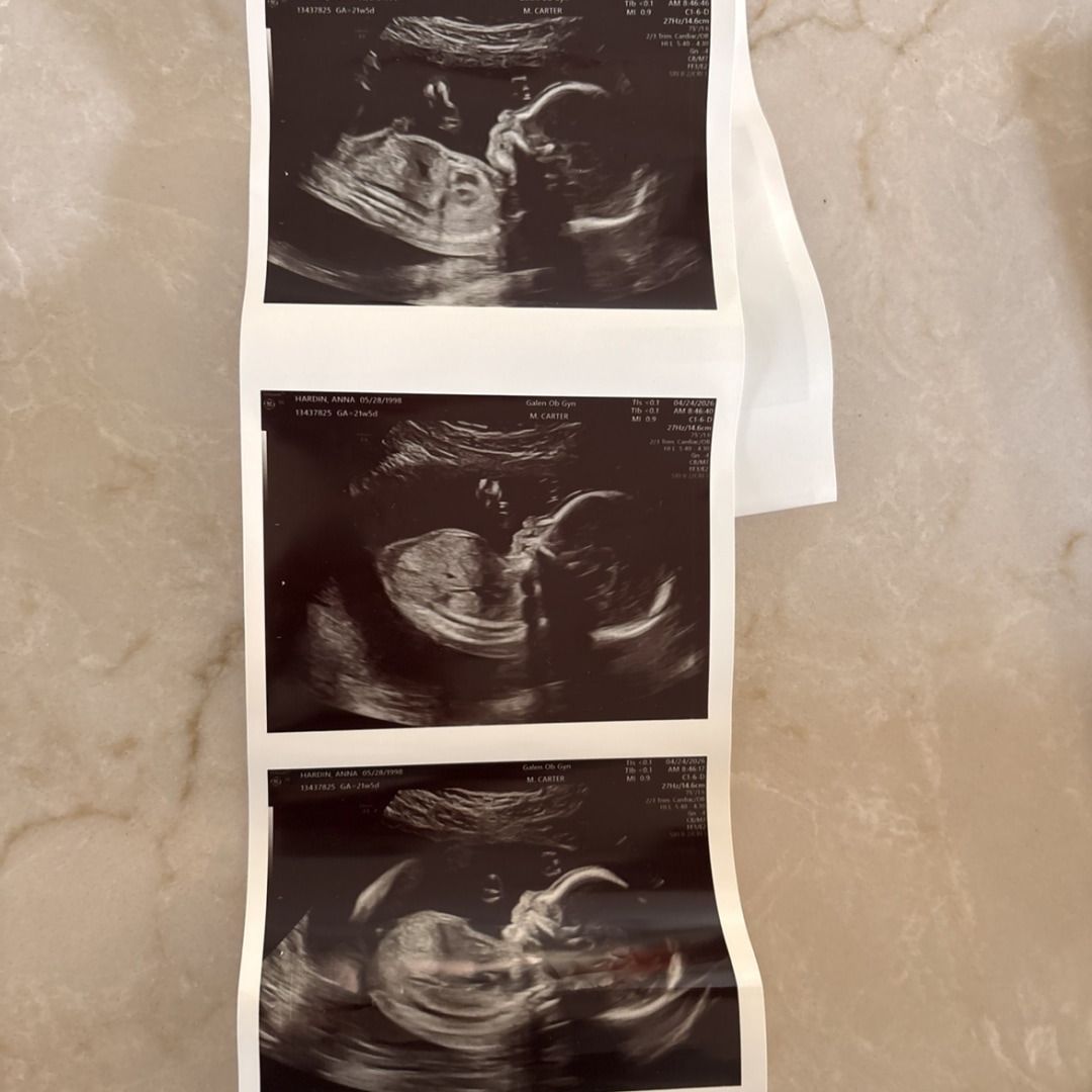 Photo shared by Anna for their Babylist baby registry.