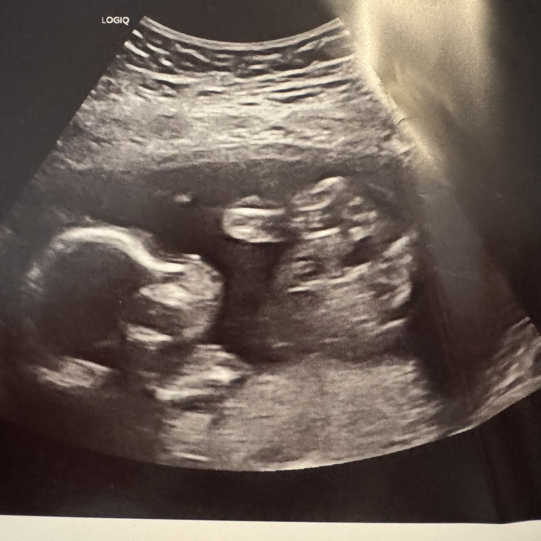 Photo shared by Alina for their Babylist baby registry.