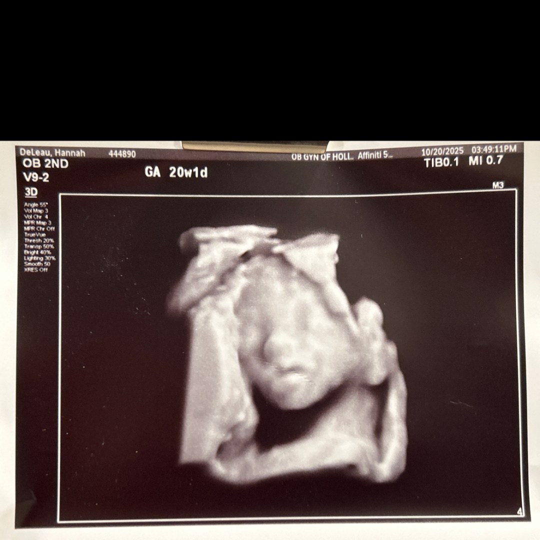 Photo shared by Hannah for their Babylist baby registry.