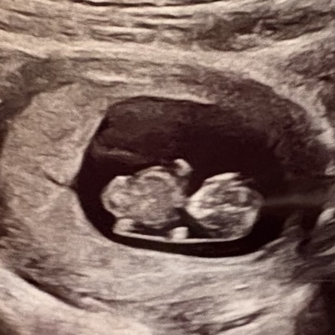 Photo shared by Holly for their Babylist baby registry.