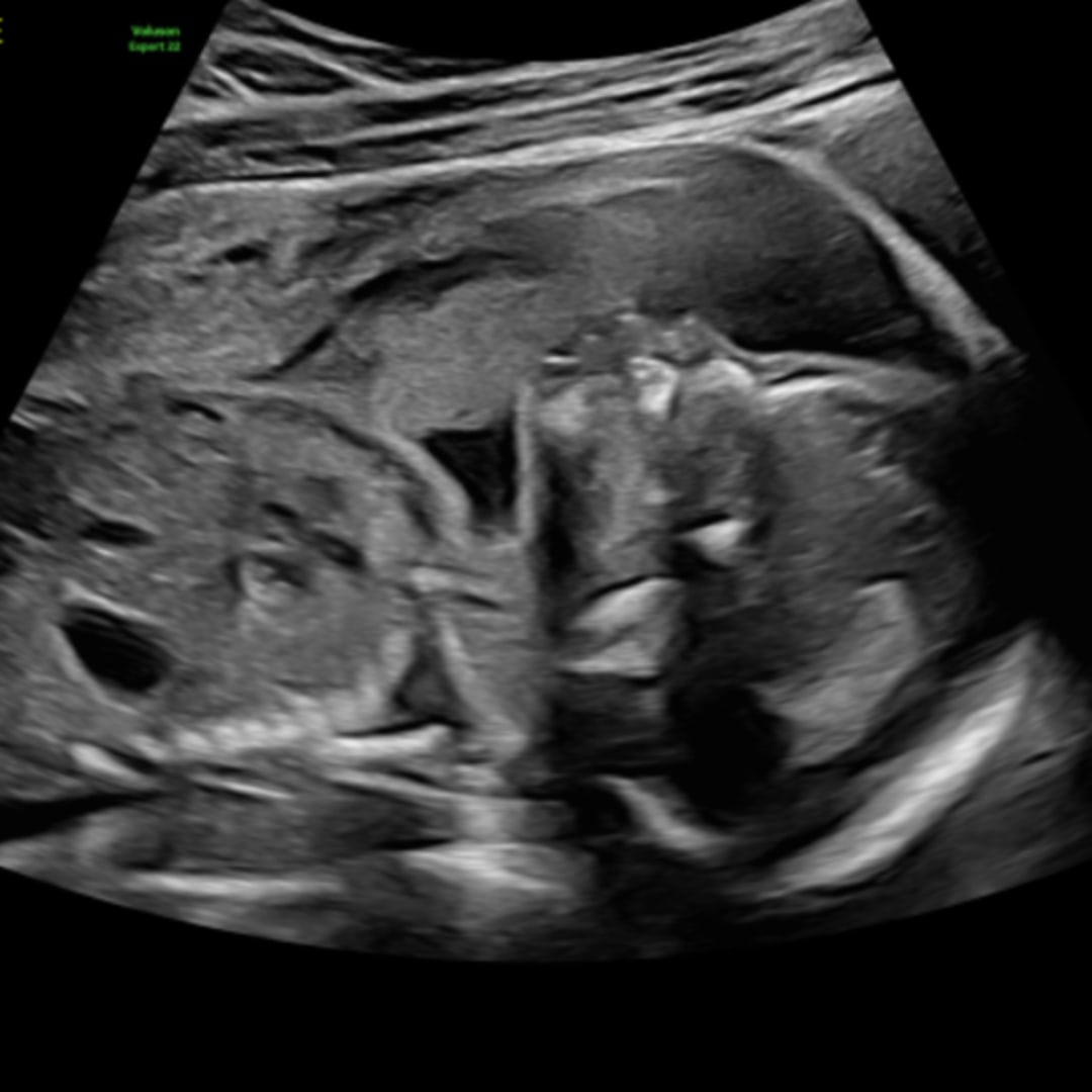 Photo shared by Hazel for their Babylist baby registry.