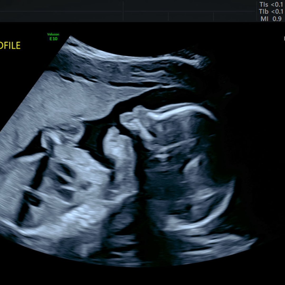 Photo shared by Kelli for their Babylist baby registry.