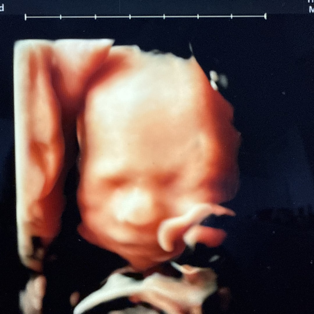 Photo shared by Olga for their Babylist baby registry.