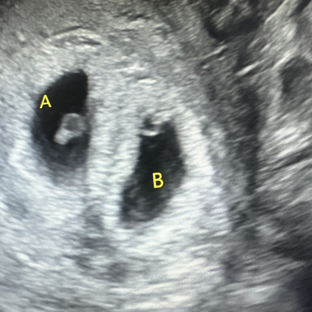 Photo shared by Rebecca for their Babylist baby registry.