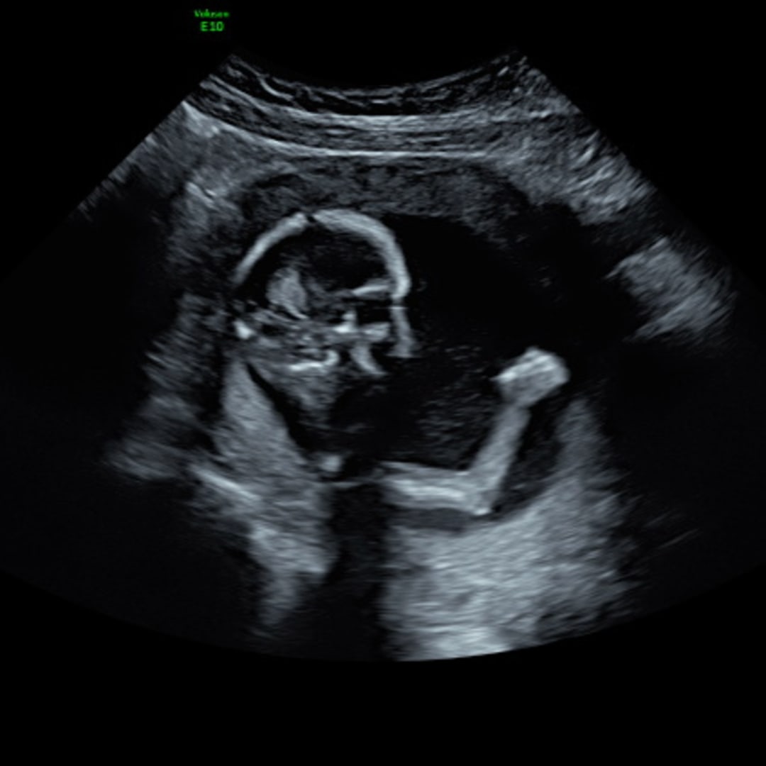 Photo shared by Carlie for their Babylist baby registry.