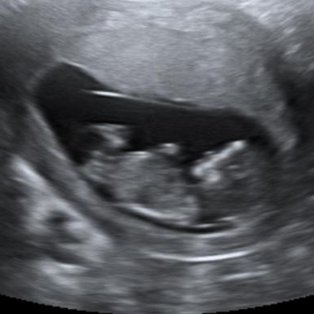 Photo shared by Alexis for their Babylist baby registry.