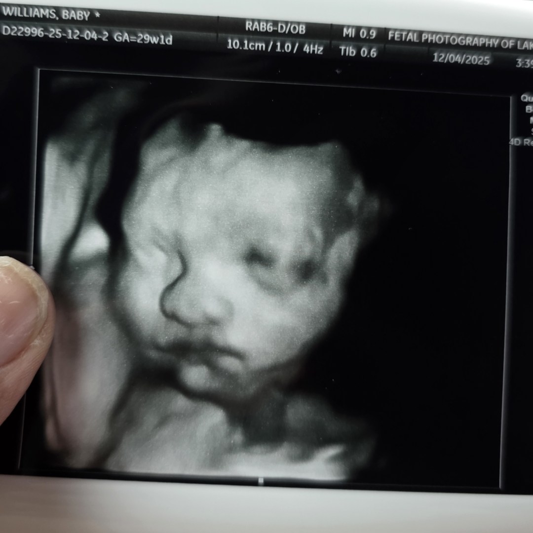 Photo shared by Aqualyn for their Babylist baby registry.