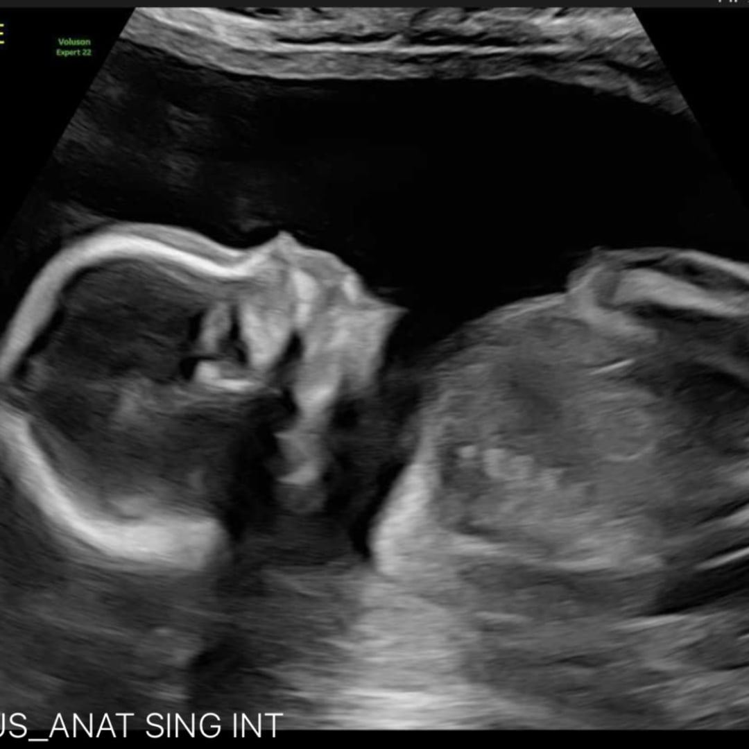 Photo shared by Alexandra for their Babylist baby registry.