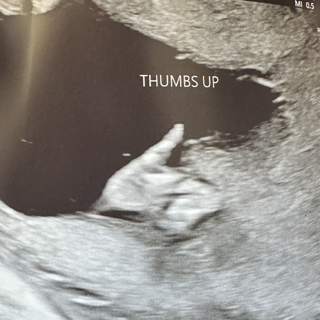 Photo shared by Clara for their Babylist baby registry.