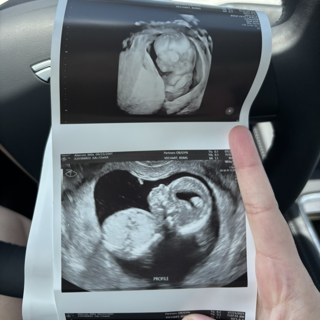 Photo shared by Mila for their Babylist baby registry.