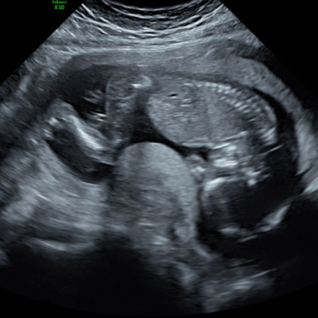 Photo shared by Malea for their Babylist baby registry.