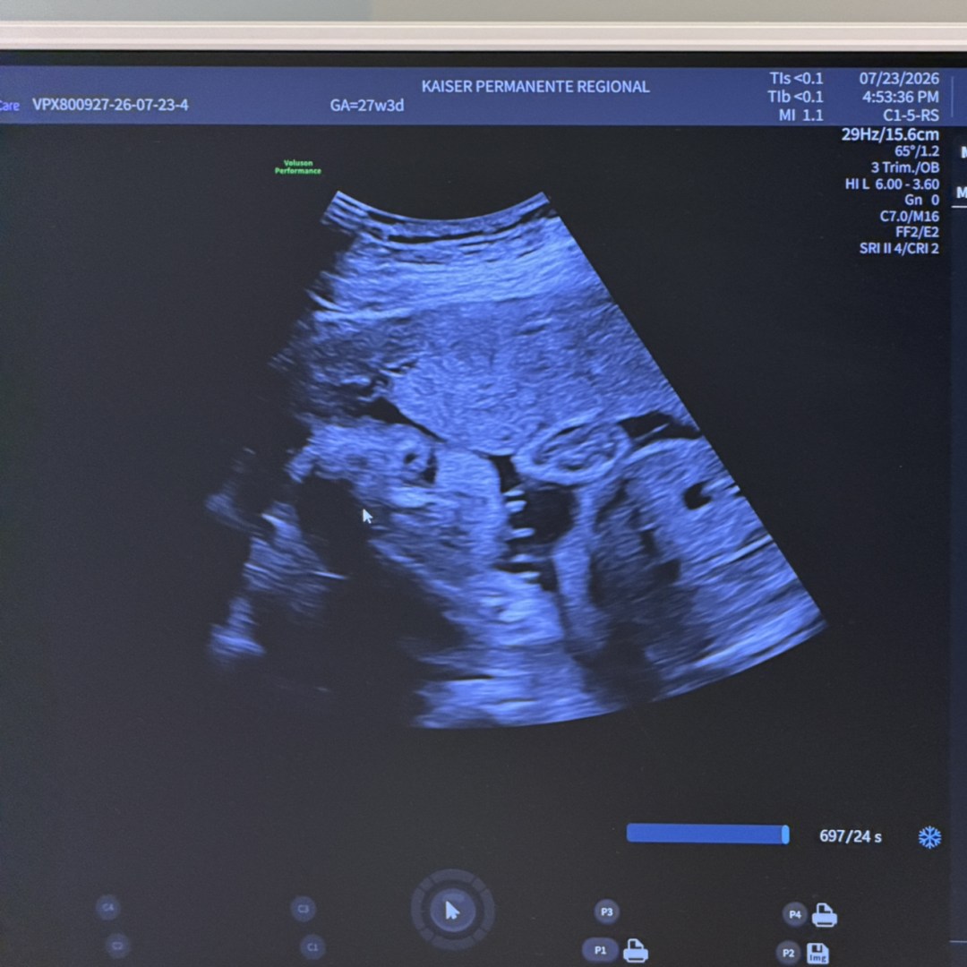 Photo shared by Sandra for their Babylist baby registry.