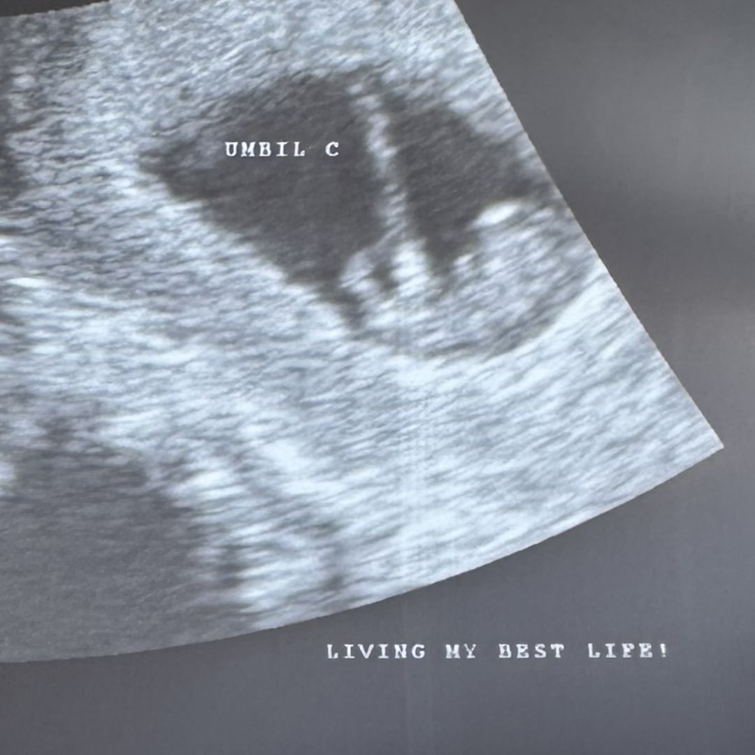 Photo shared by Kandace for their Babylist baby registry.