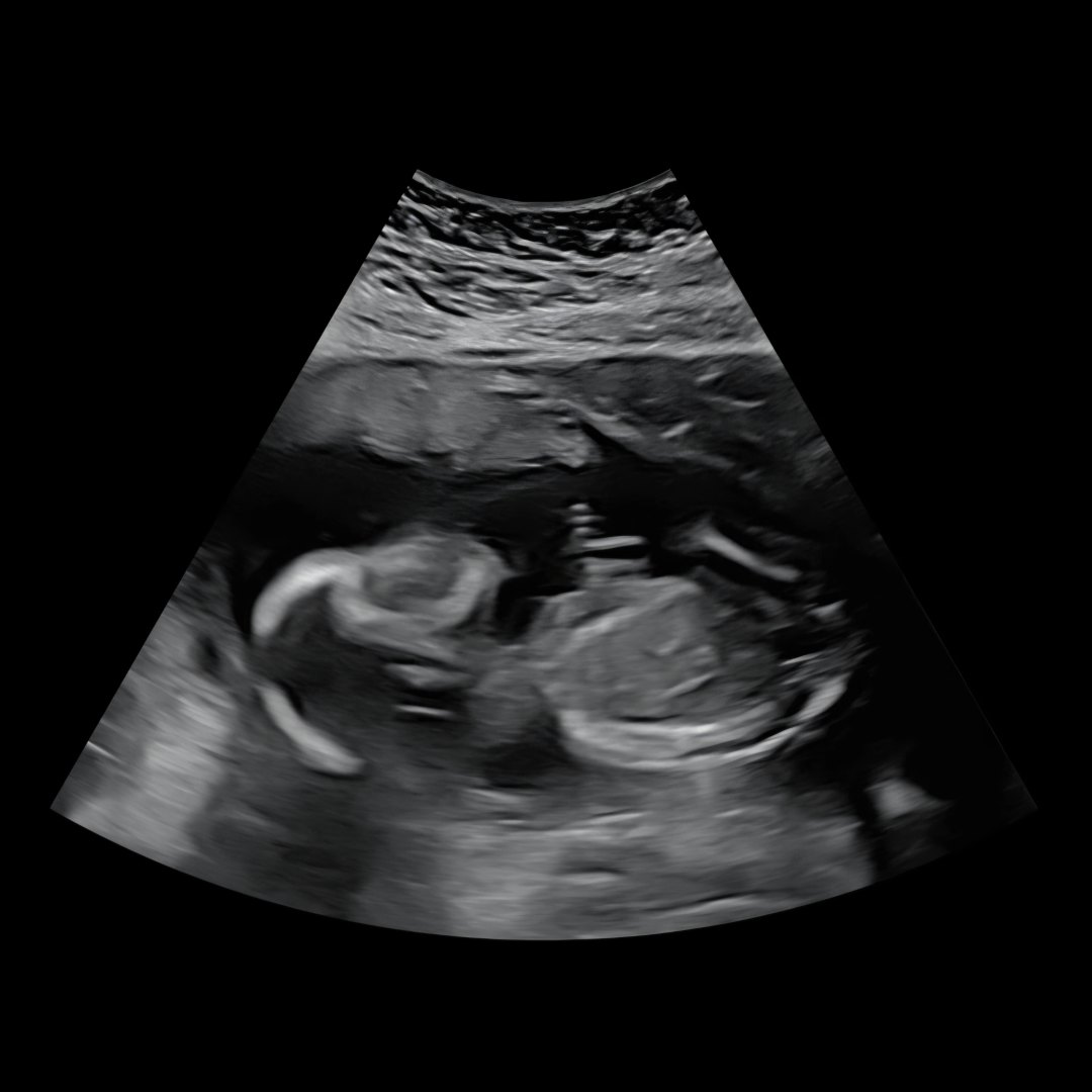 Photo shared by Arleen for their Babylist baby registry.
