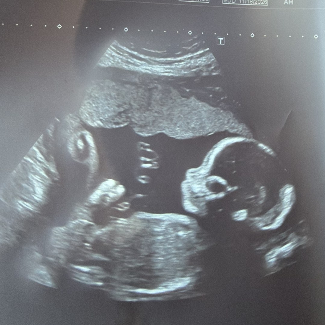 Photo shared by Kaitlain for their Babylist baby registry.