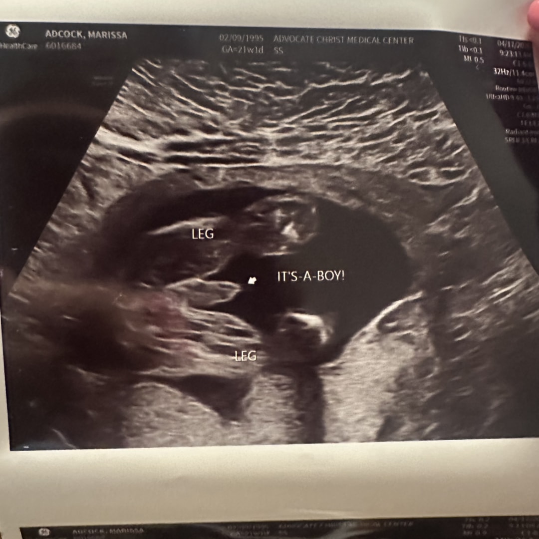 Photo shared by Marissa for their Babylist baby registry.