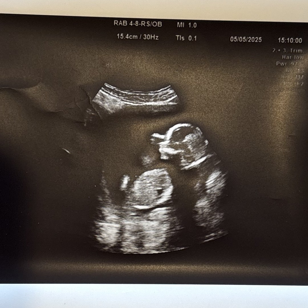 Photo shared by Haley for their Babylist baby registry.