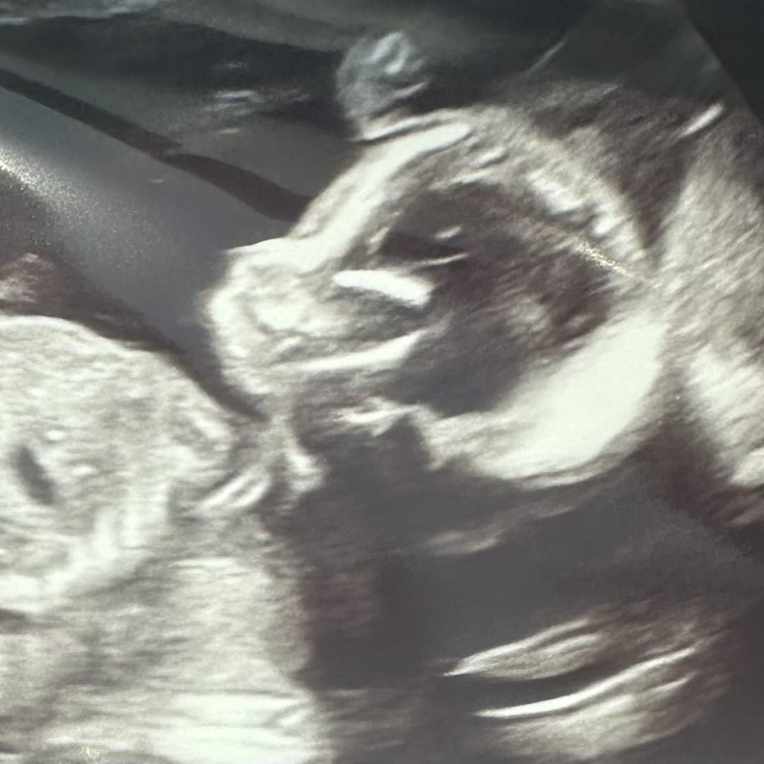 Photo shared by Katie for their Babylist baby registry.