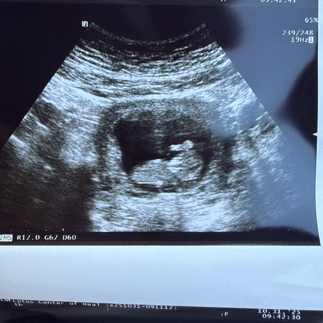 Photo shared by Abi for their Babylist baby registry.