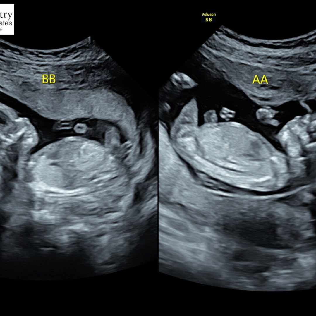 Photo shared by Frankie for their Babylist baby registry.
