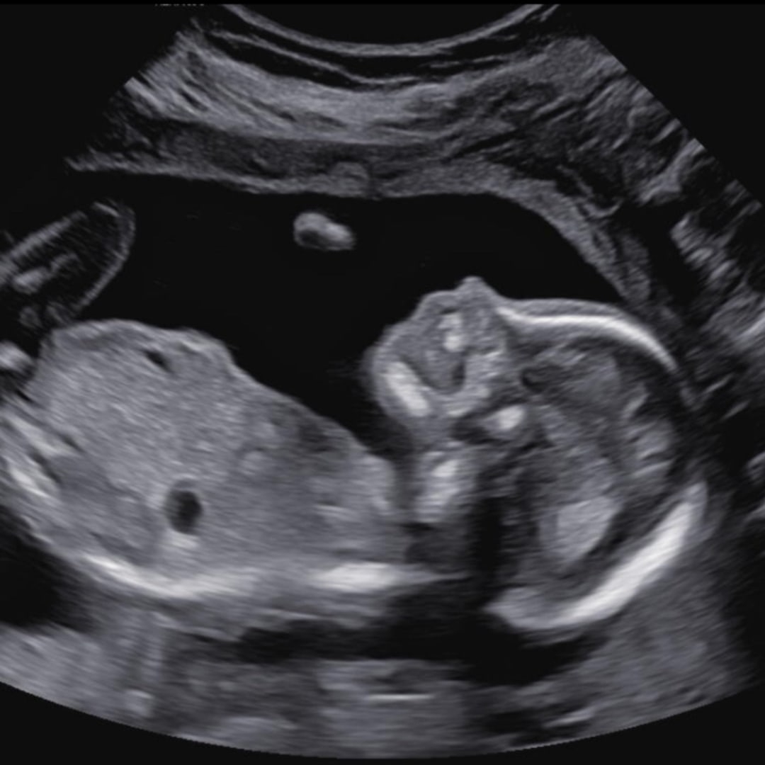 Photo shared by Carissa for their Babylist baby registry.
