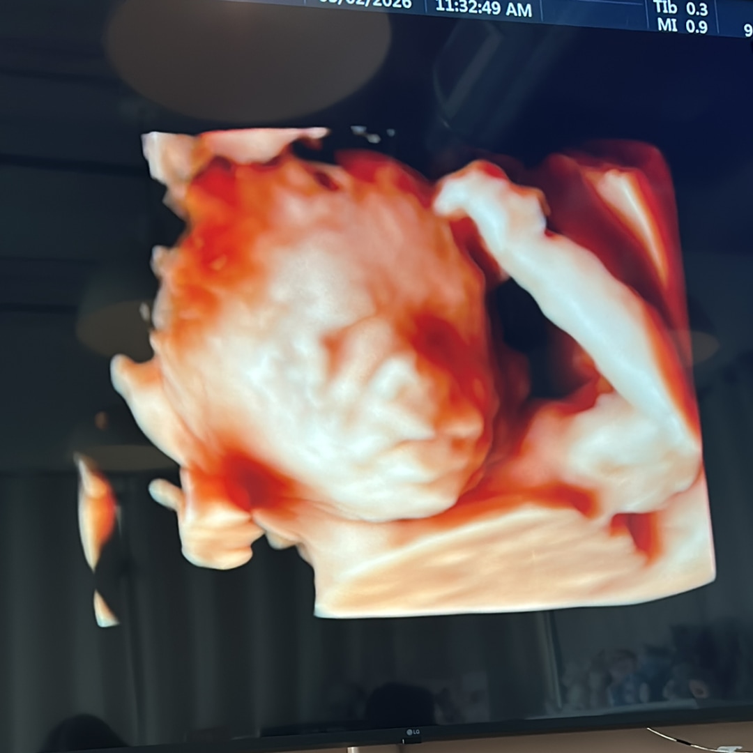 Photo shared by Josselyn for their Babylist baby registry.