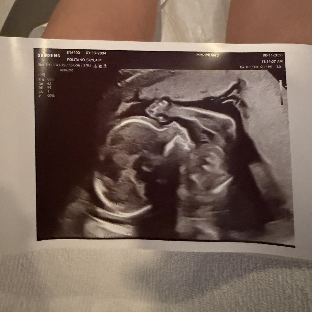 Photo shared by Skyla for their Babylist baby registry.