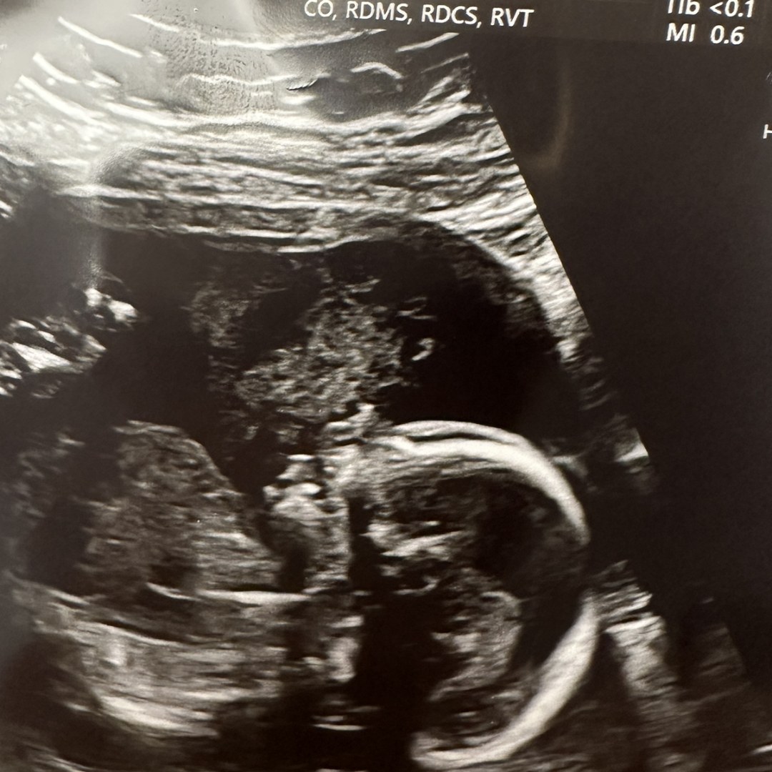 Photo shared by Kaylena for their Babylist baby registry.
