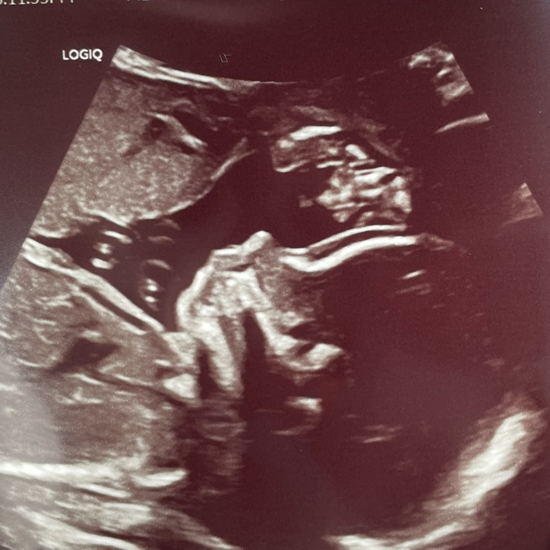 Photo shared by Hailey for their Babylist baby registry.