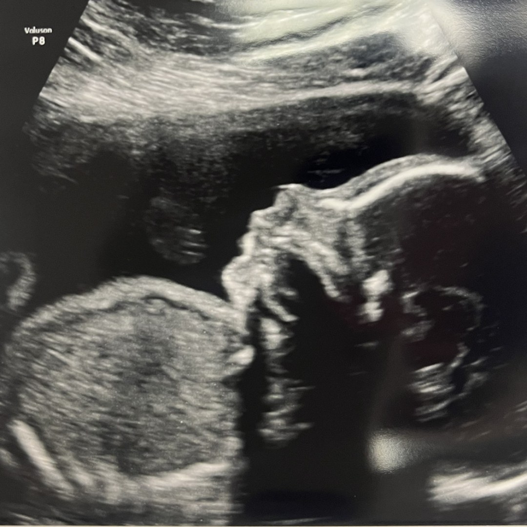 Photo shared by Haven for their Babylist baby registry.