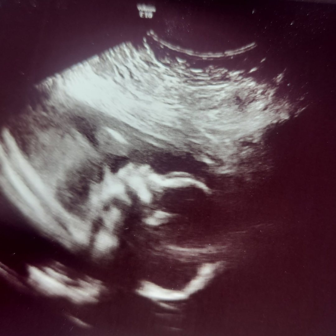 Photo shared by Adrianna for their Babylist baby registry.