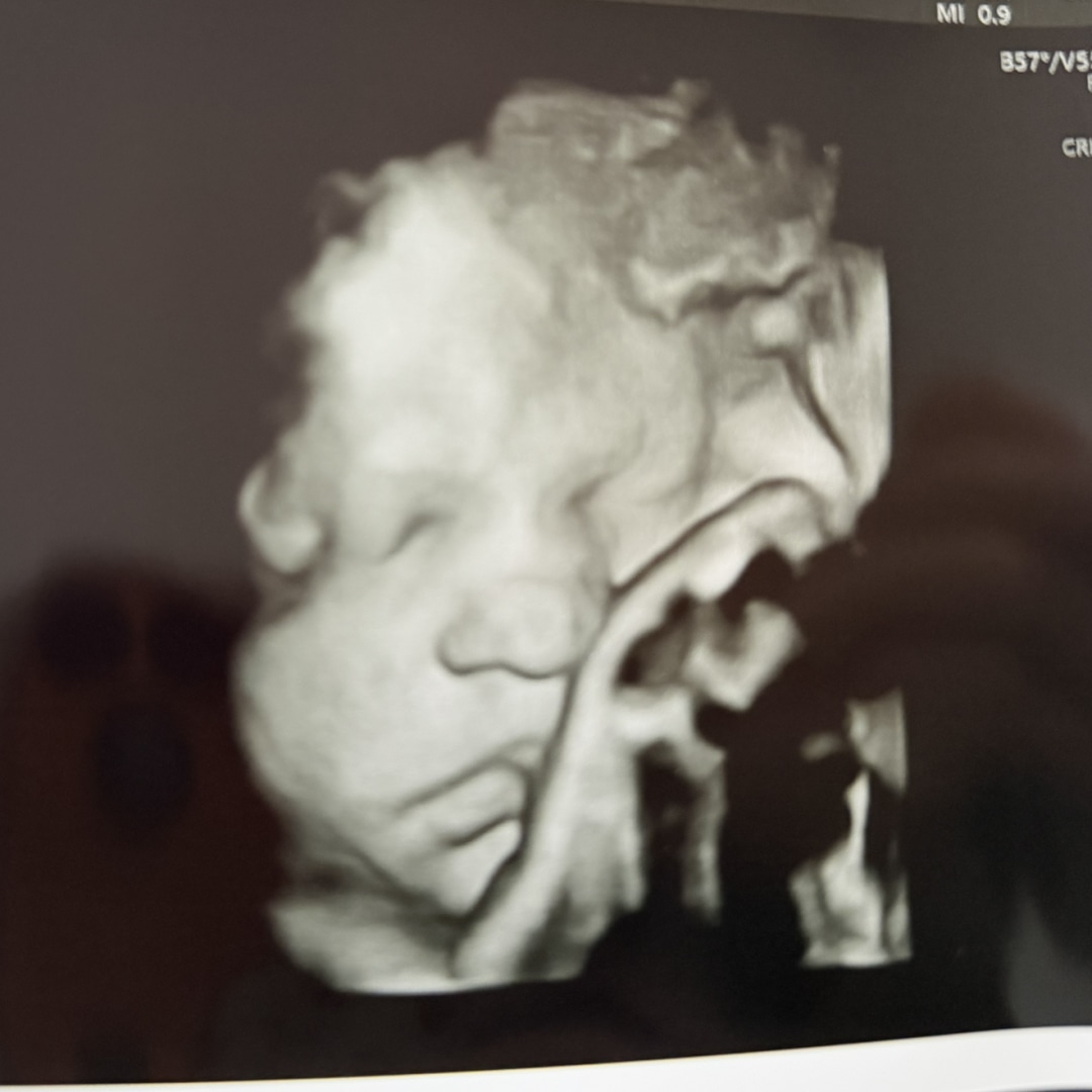 Photo shared by Patricia for their Babylist baby registry.
