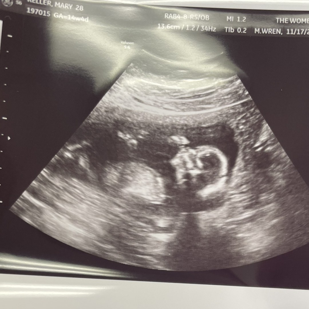 Photo shared by Danni for their Babylist baby registry.