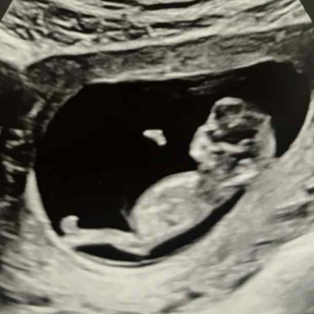 Photo shared by Erika for their Babylist baby registry.