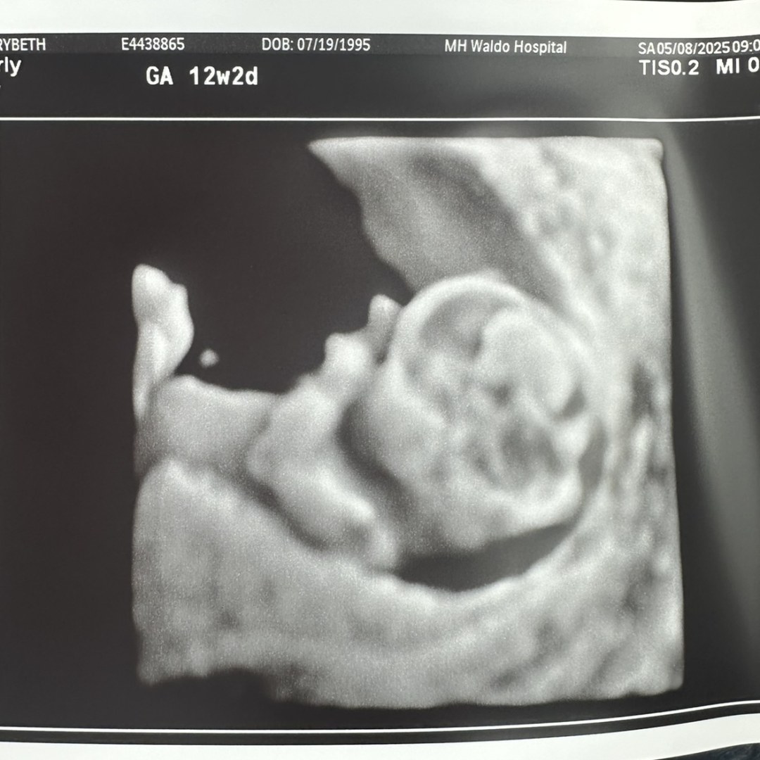 Photo shared by Marybeth for their Babylist baby registry.