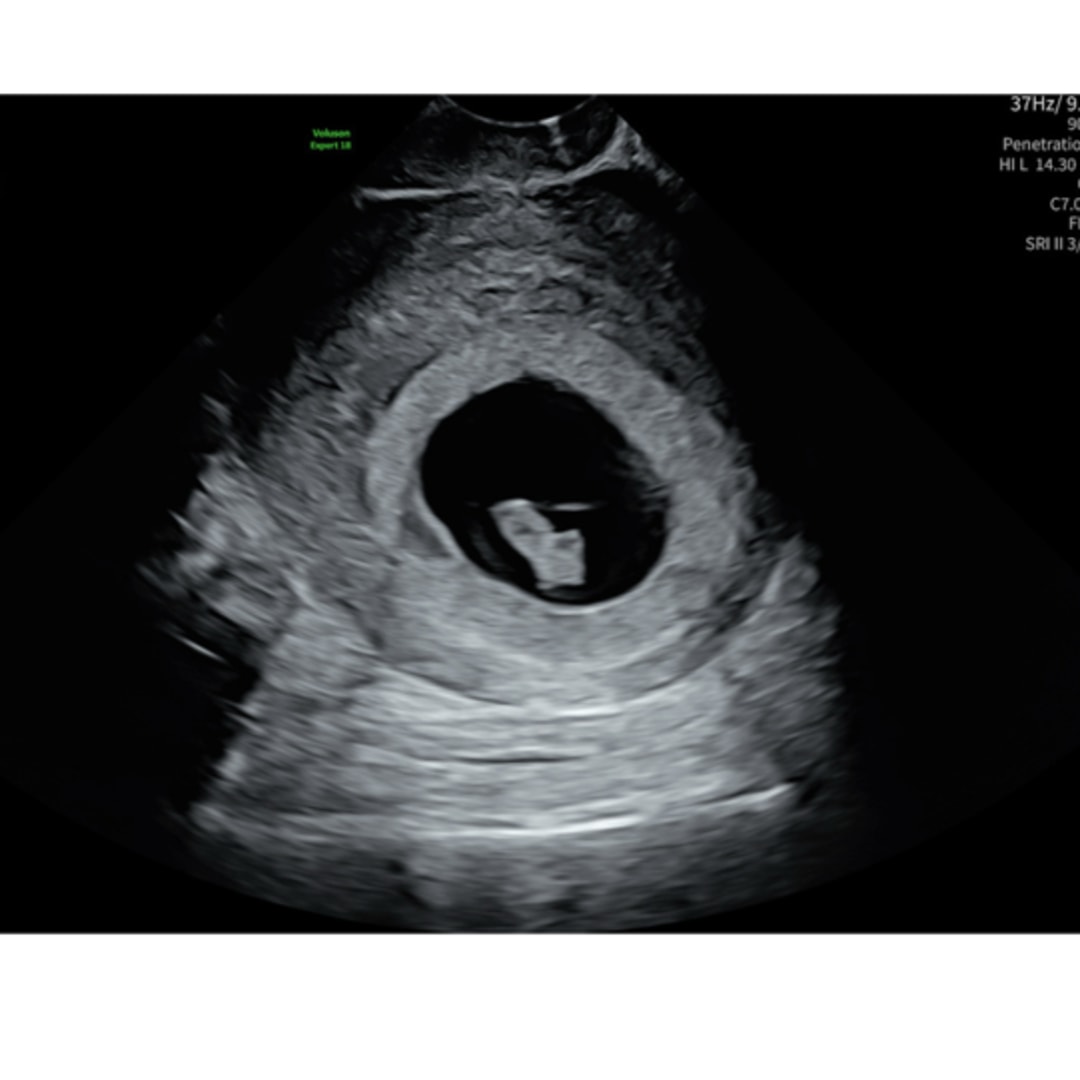 Photo shared by Jaden for their Babylist baby registry.