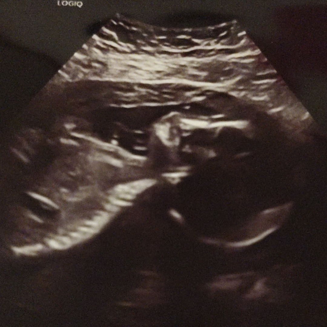 Photo shared by Ivey for their Babylist baby registry.
