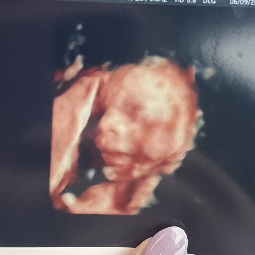Photo shared by Anna for their Babylist baby registry.