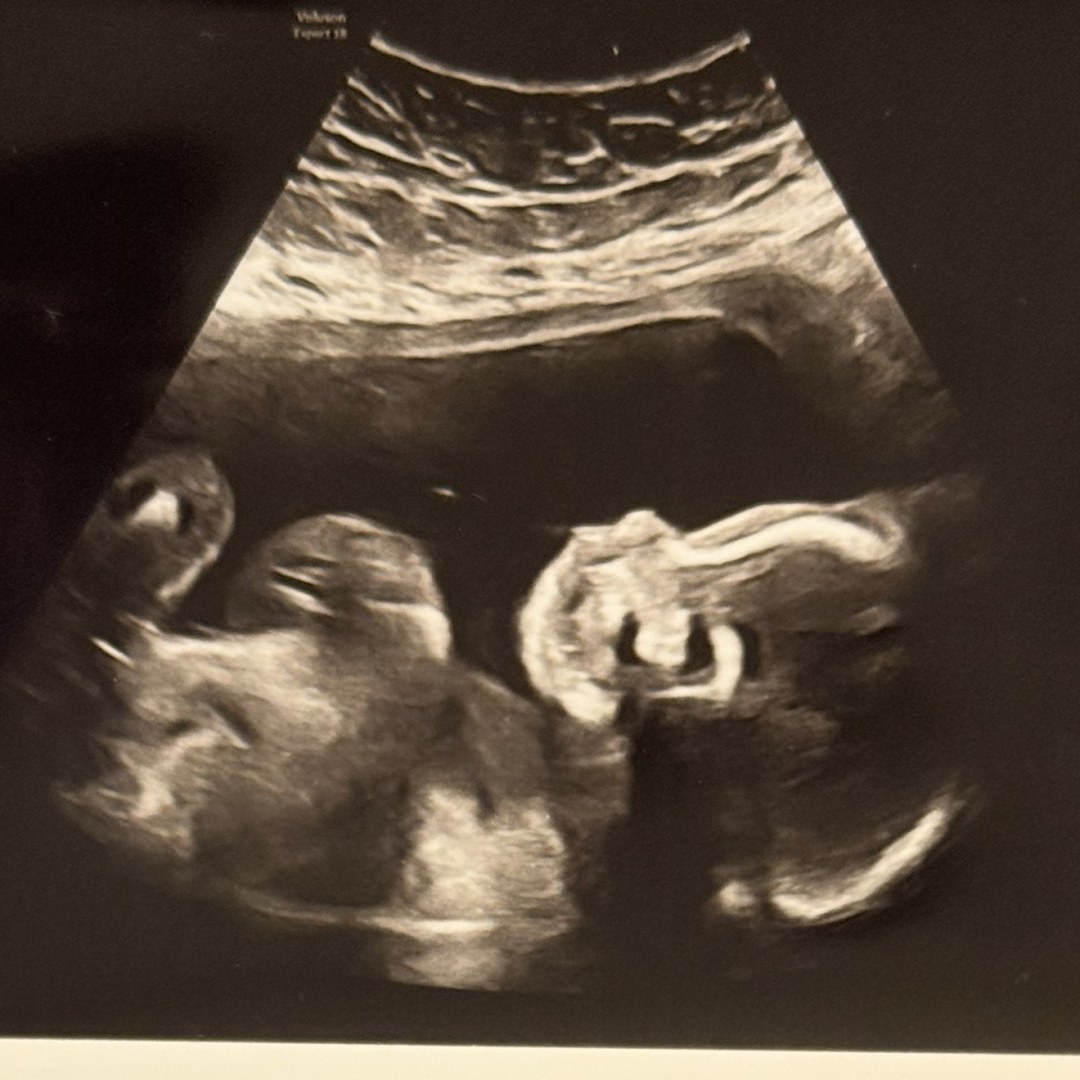 Photo shared by Mayla for their Babylist baby registry.