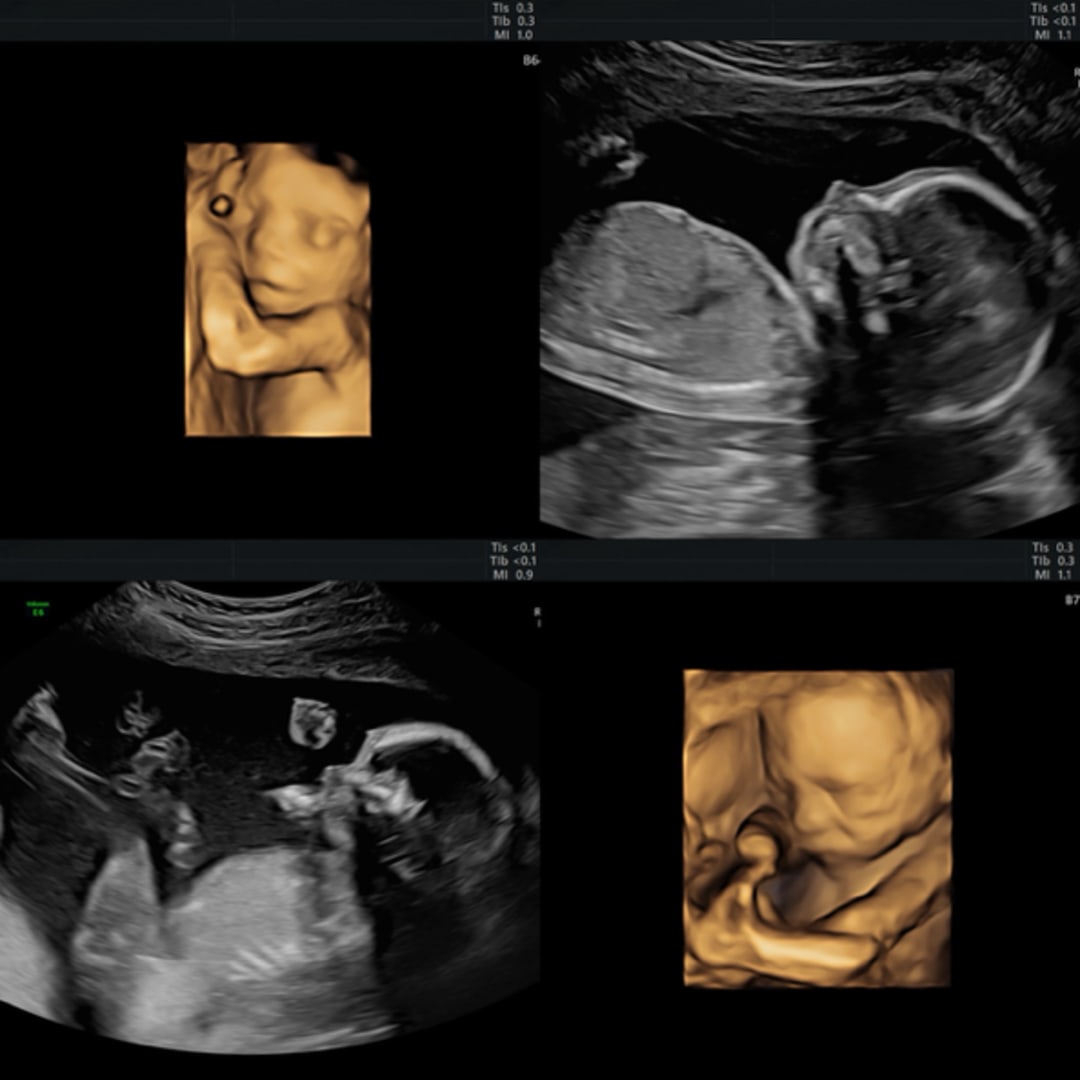 Photo shared by Dennisha for their Babylist baby registry.