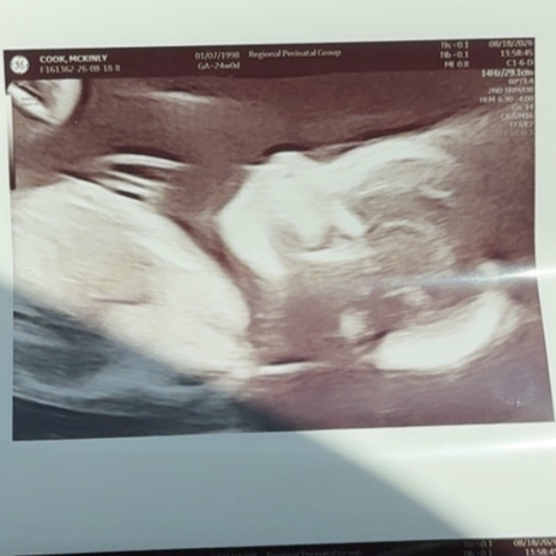 Photo shared by Mckinly for their Babylist baby registry.