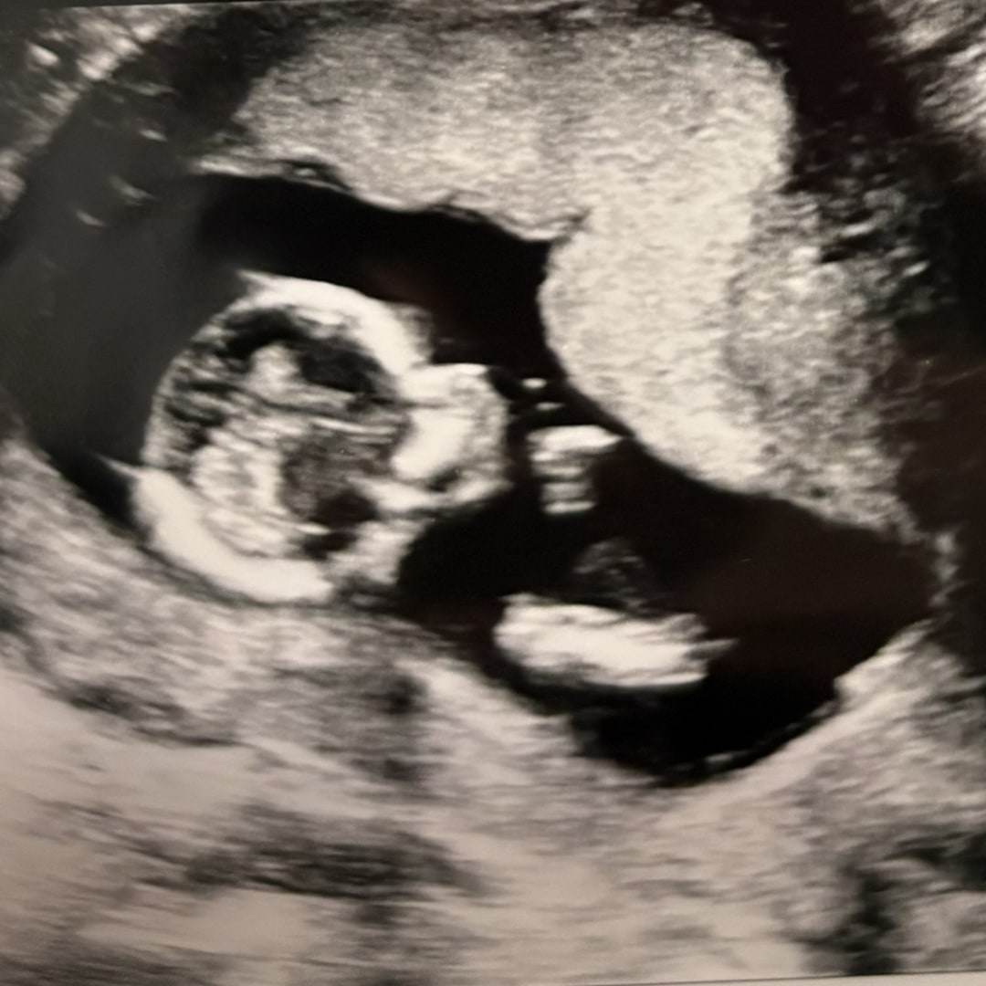 Photo shared by Janavia for their Babylist baby registry.