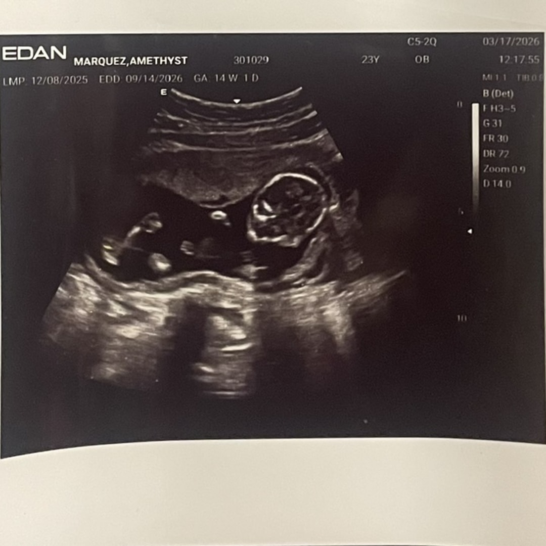 Photo shared by Amethyst for their Babylist baby registry.