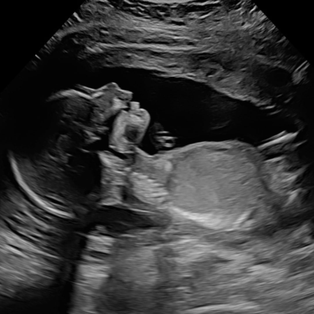 Photo shared by Carly for their Babylist baby registry.
