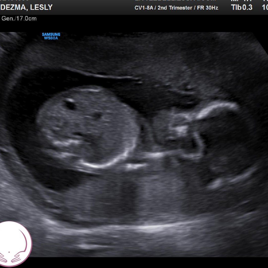 Photo shared by Lesly for their Babylist baby registry.