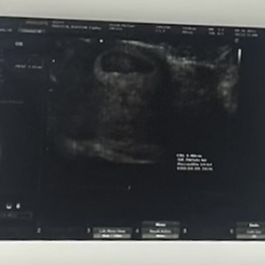 Photo shared by Cheyenne for their Babylist baby registry.