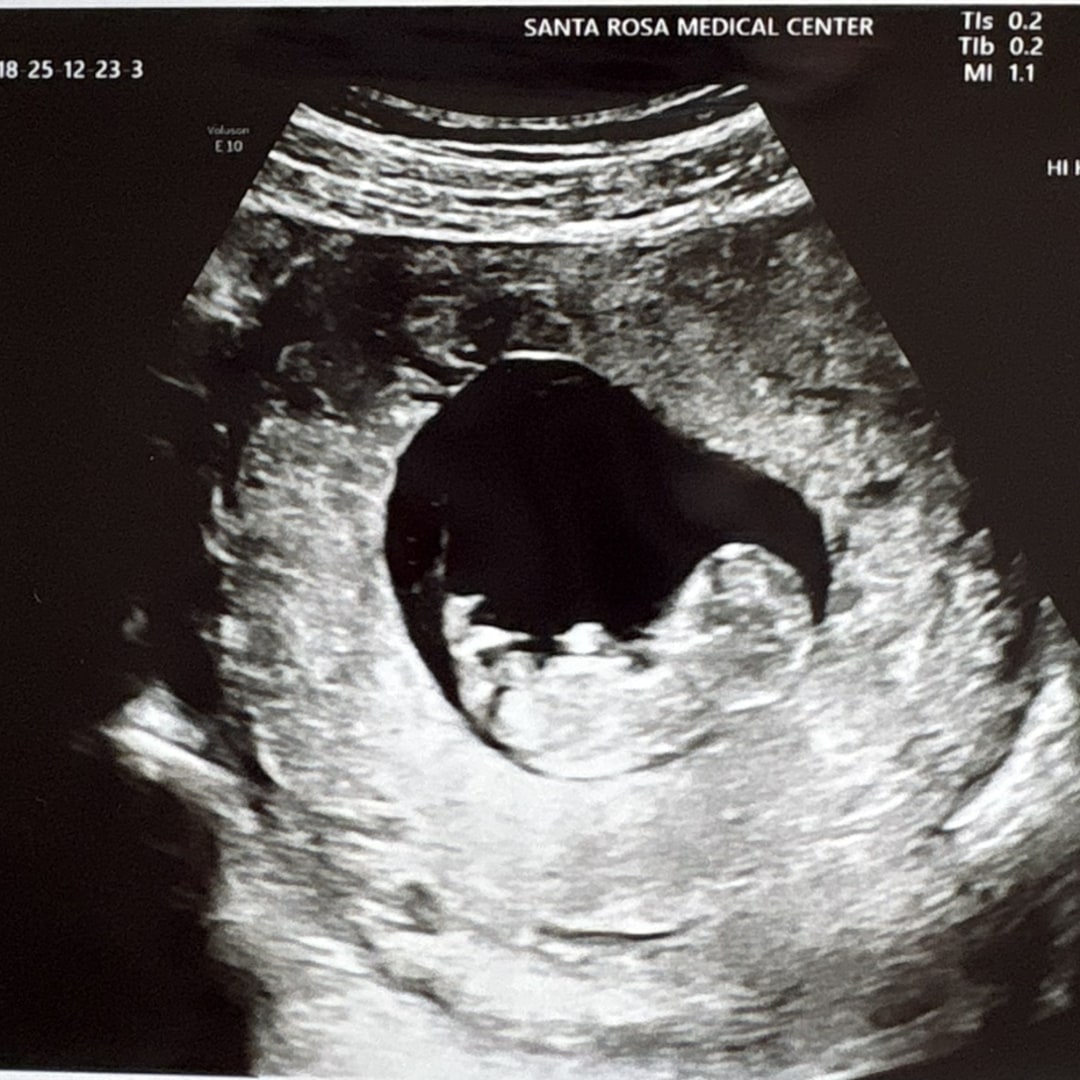 Photo shared by Megan for their Babylist baby registry.