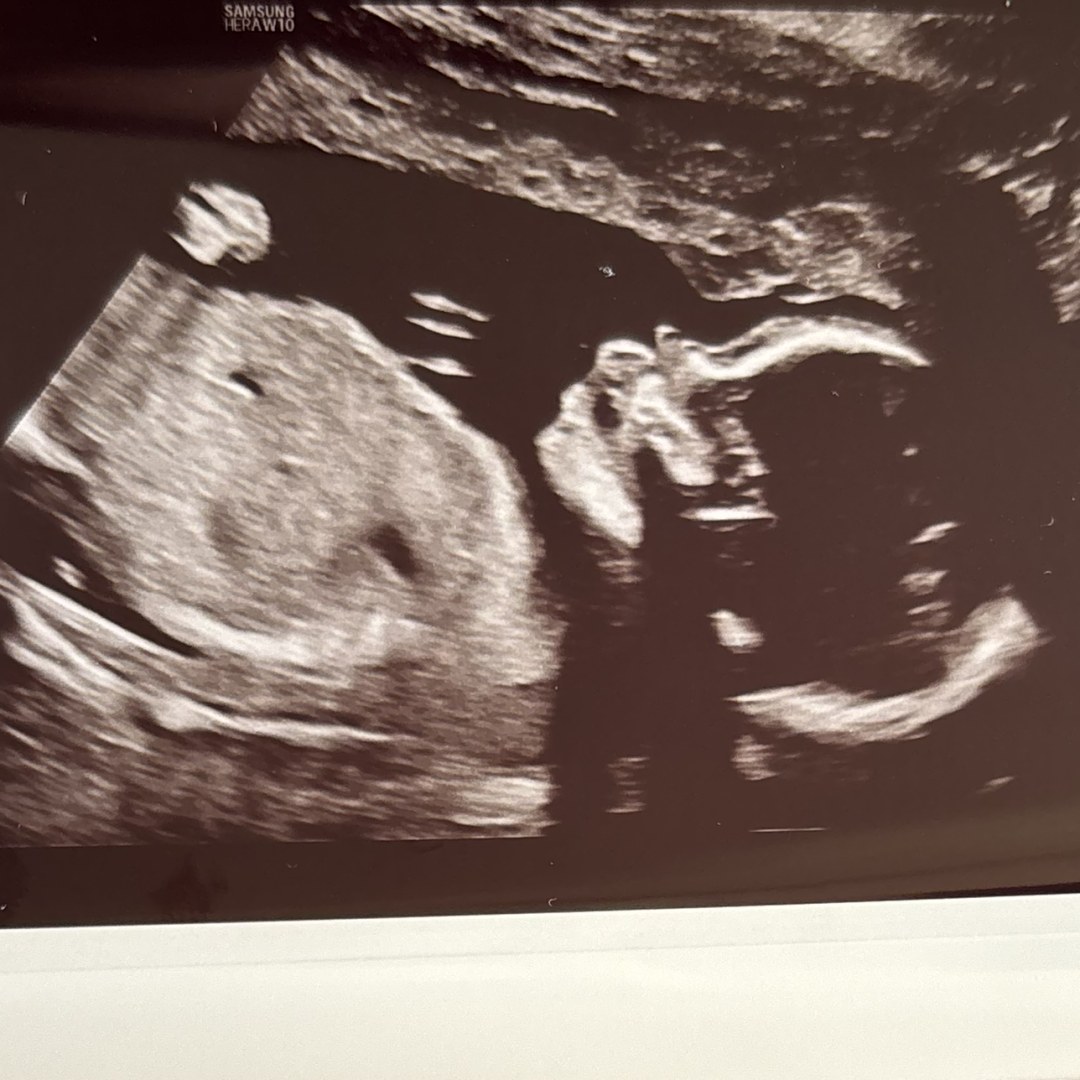 Photo shared by Domonique for their Babylist baby registry.