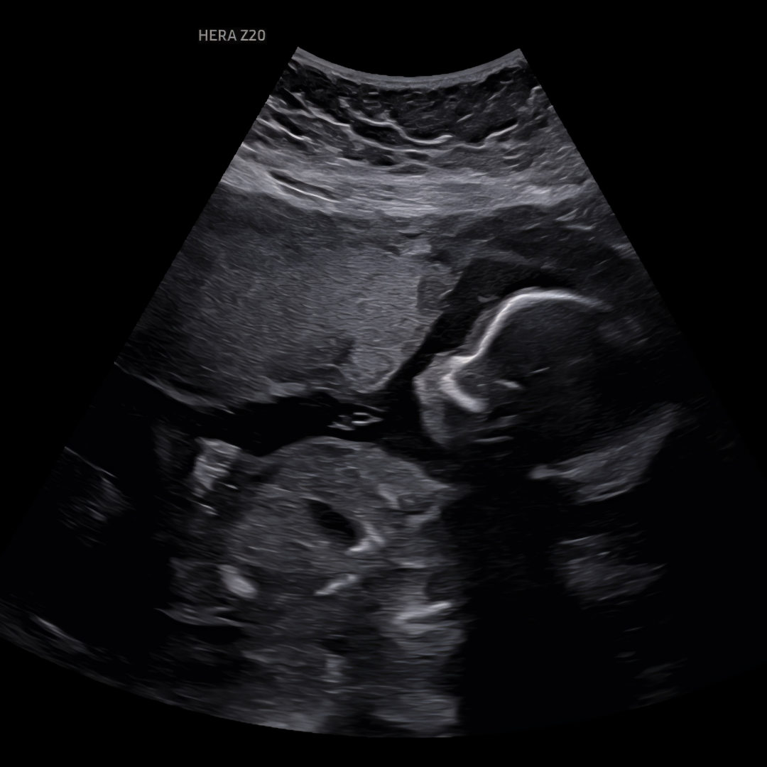 Photo shared by Talley for their Babylist baby registry.